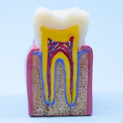 根幹治療（歯内療法）